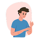 Skin rash